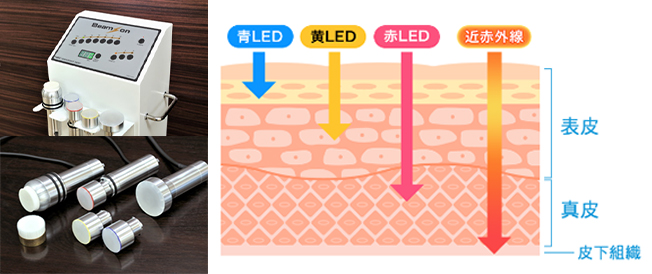 ビームオンフェイシャルトリートメントその2