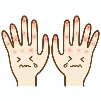肌の新陳代謝とステロイド